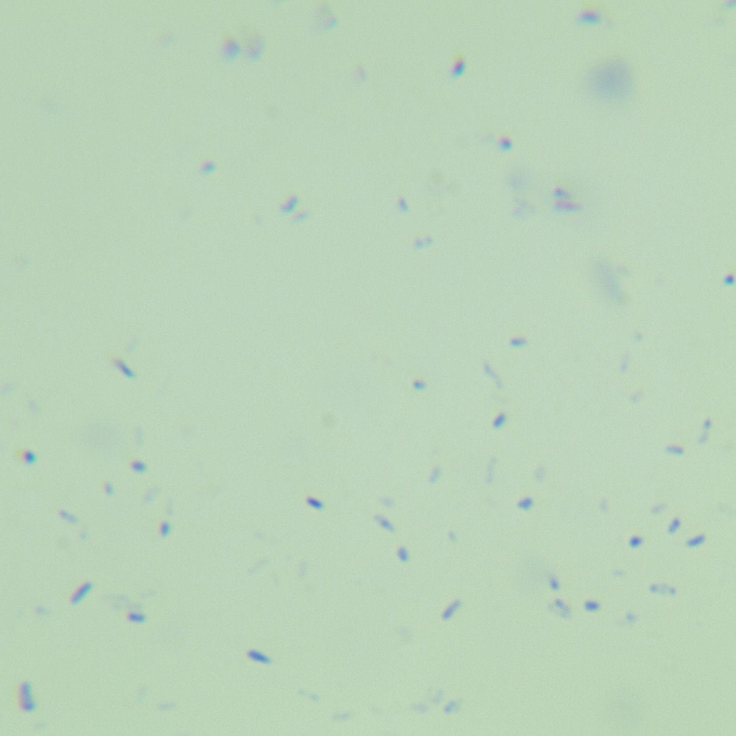 Heidelberg mycobacteria-BNCC