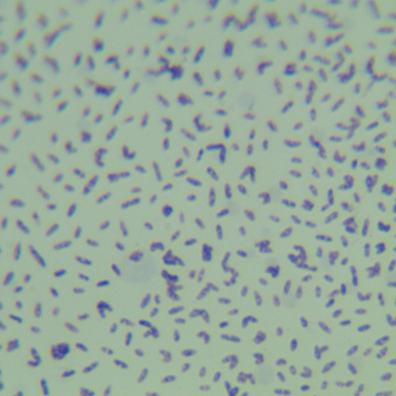 Mycobacterium hei-BNCC