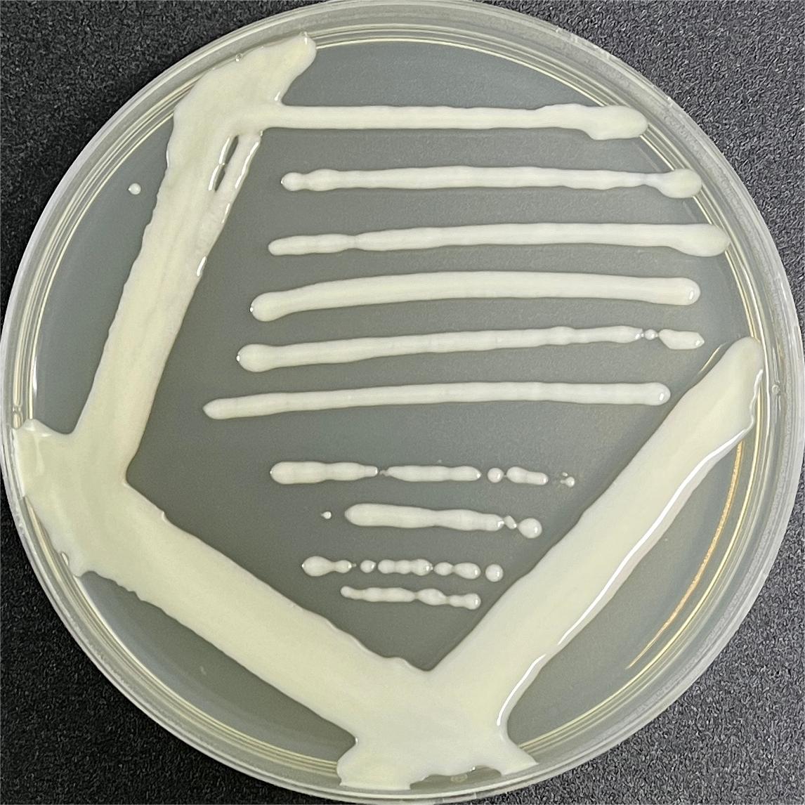 Mycobacterium hei-BNCC