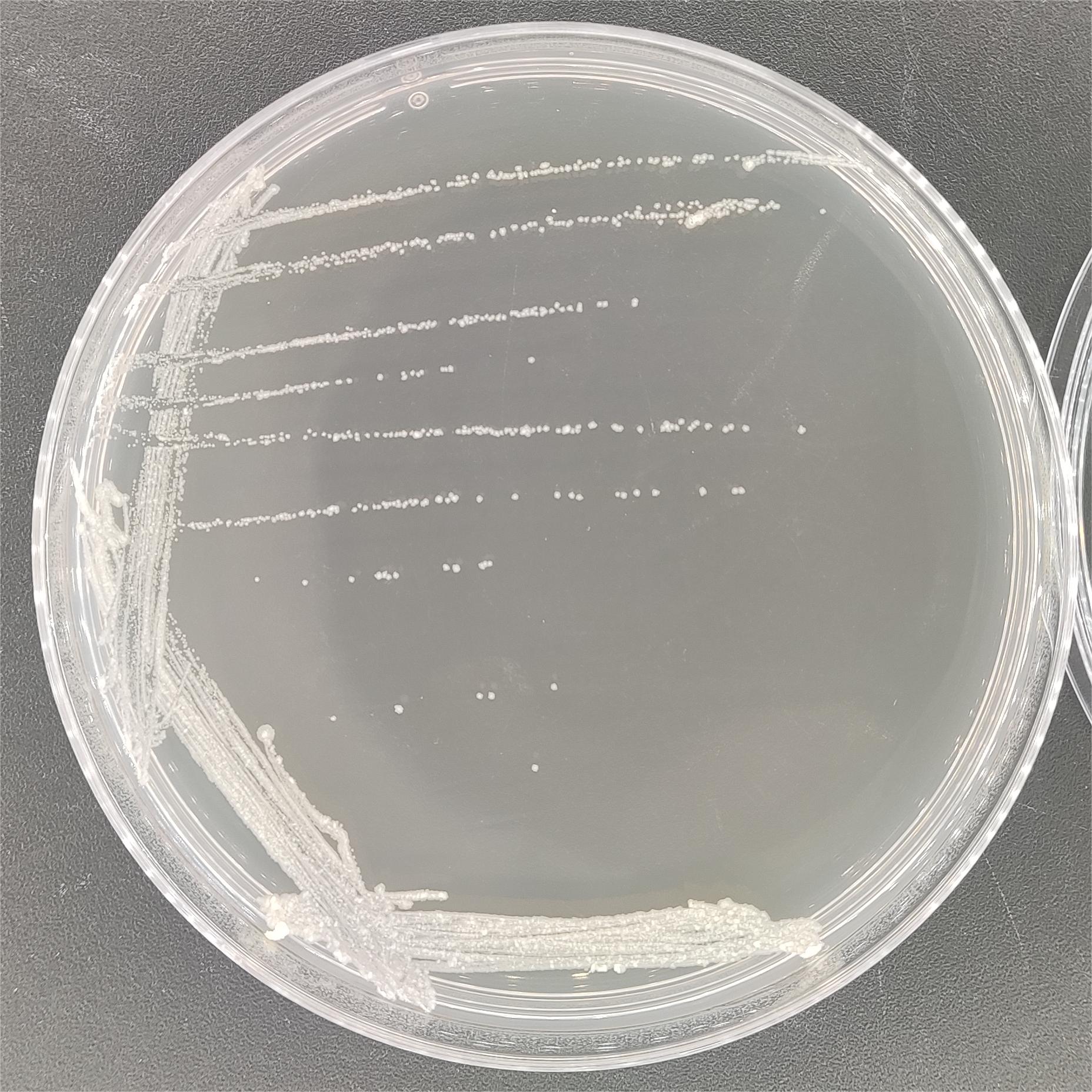 New Orleans mycobacteria-BNCC