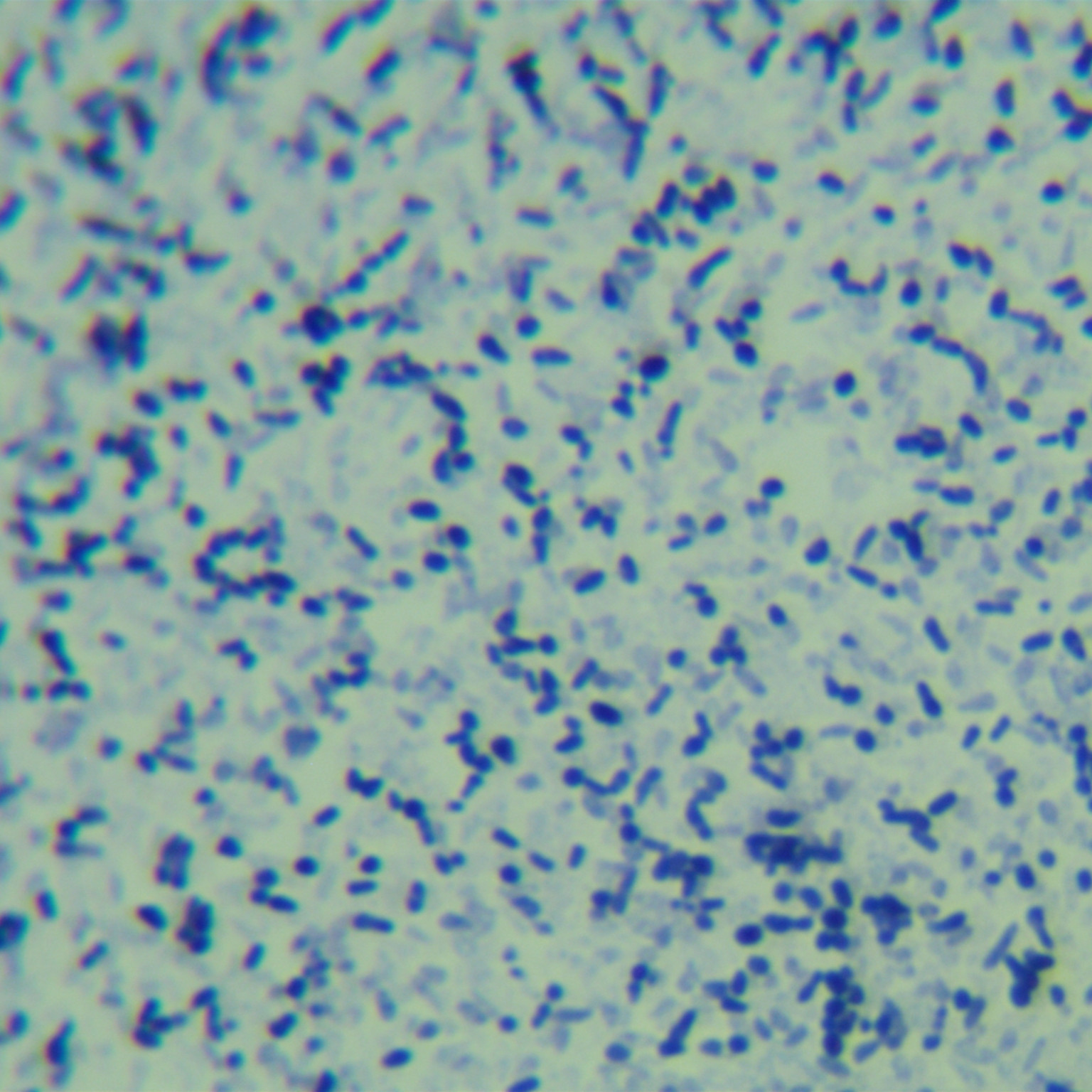 Marsh mycobacteria-BNCC