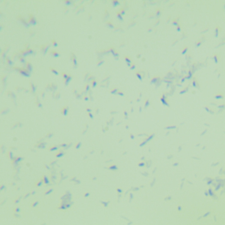 Bacillus subtilis-BNCC