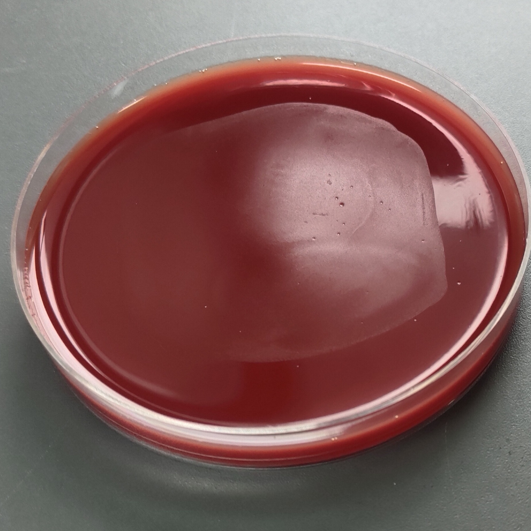 Helicobacter pylori-BNCC