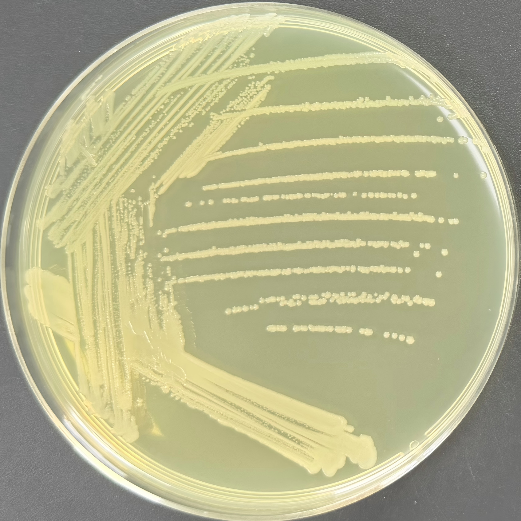 HT115 (DE3) Escherichia coli-BNCC