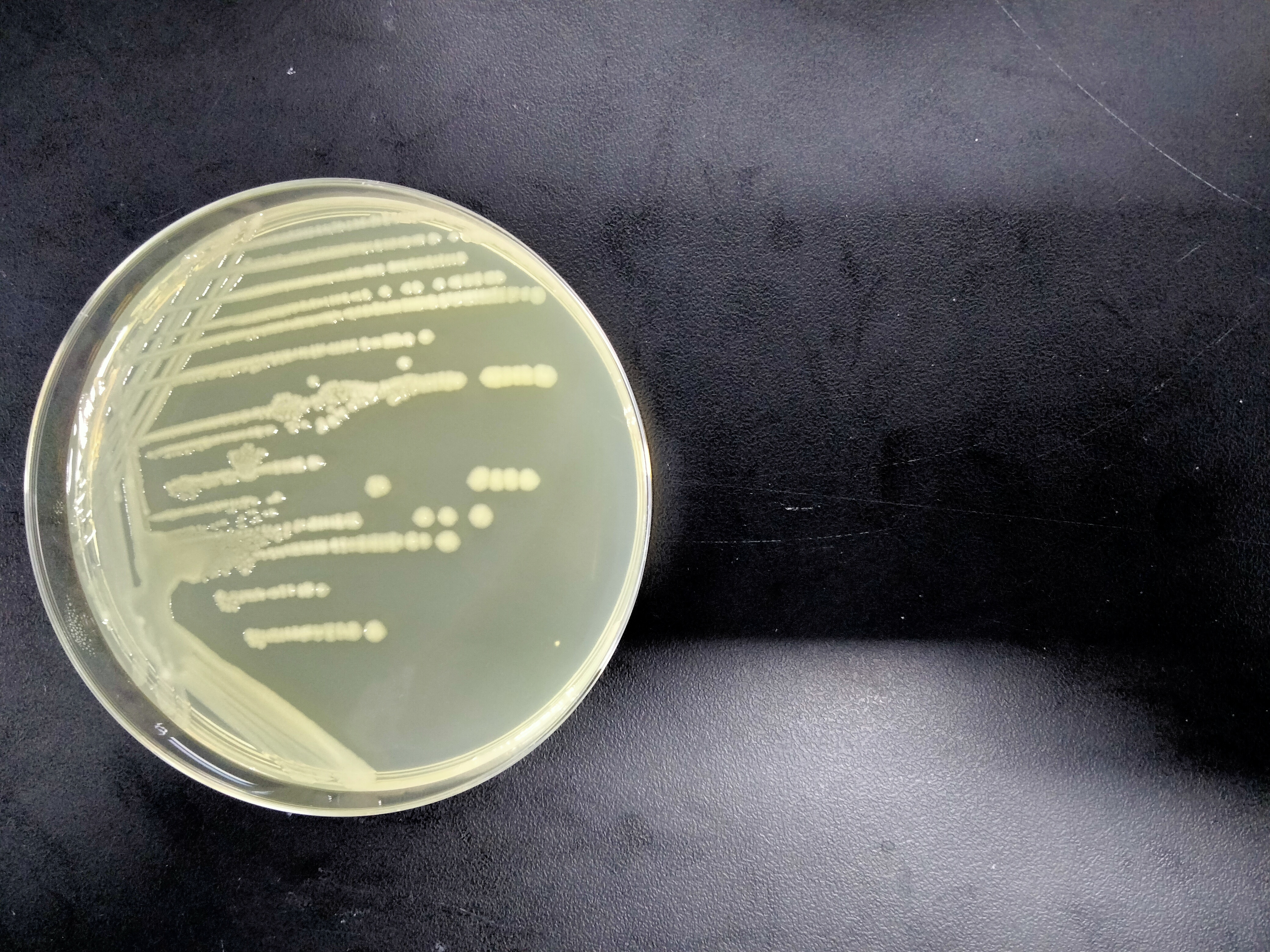 M15 (pREP4) Escherichia coli-BNCC