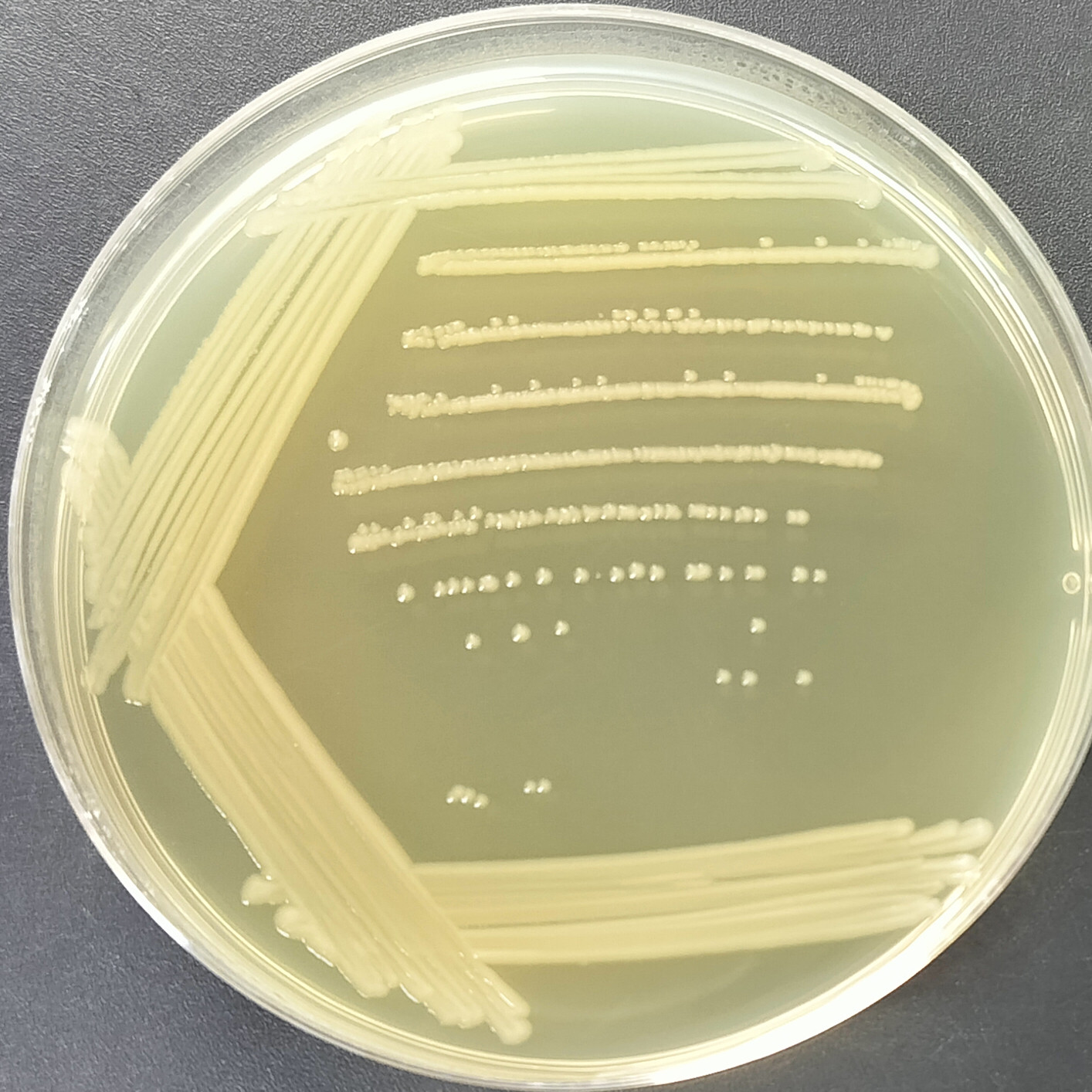 Escherichia coli-BNCC