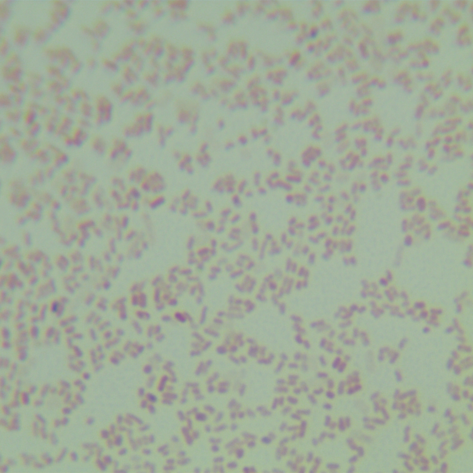 Escherichia coli-BNCC