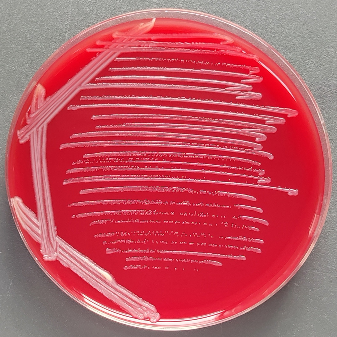 Pseudomonas aeruginosa-BNCC