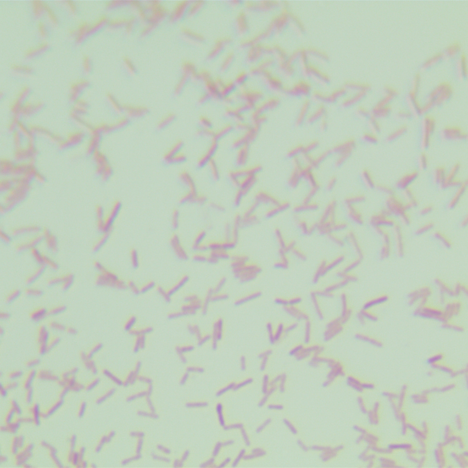 Pseudomonas aeruginosa-BNCC