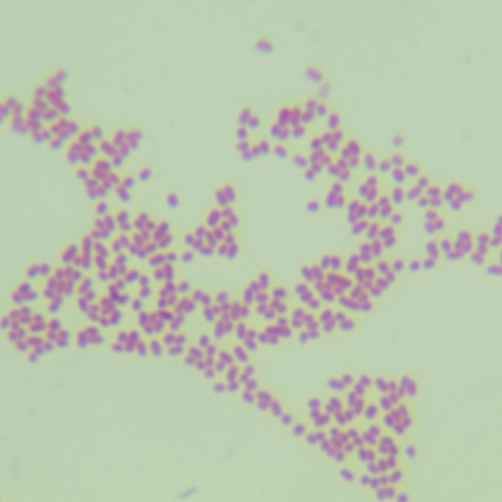 Escherichia coli-BNCC