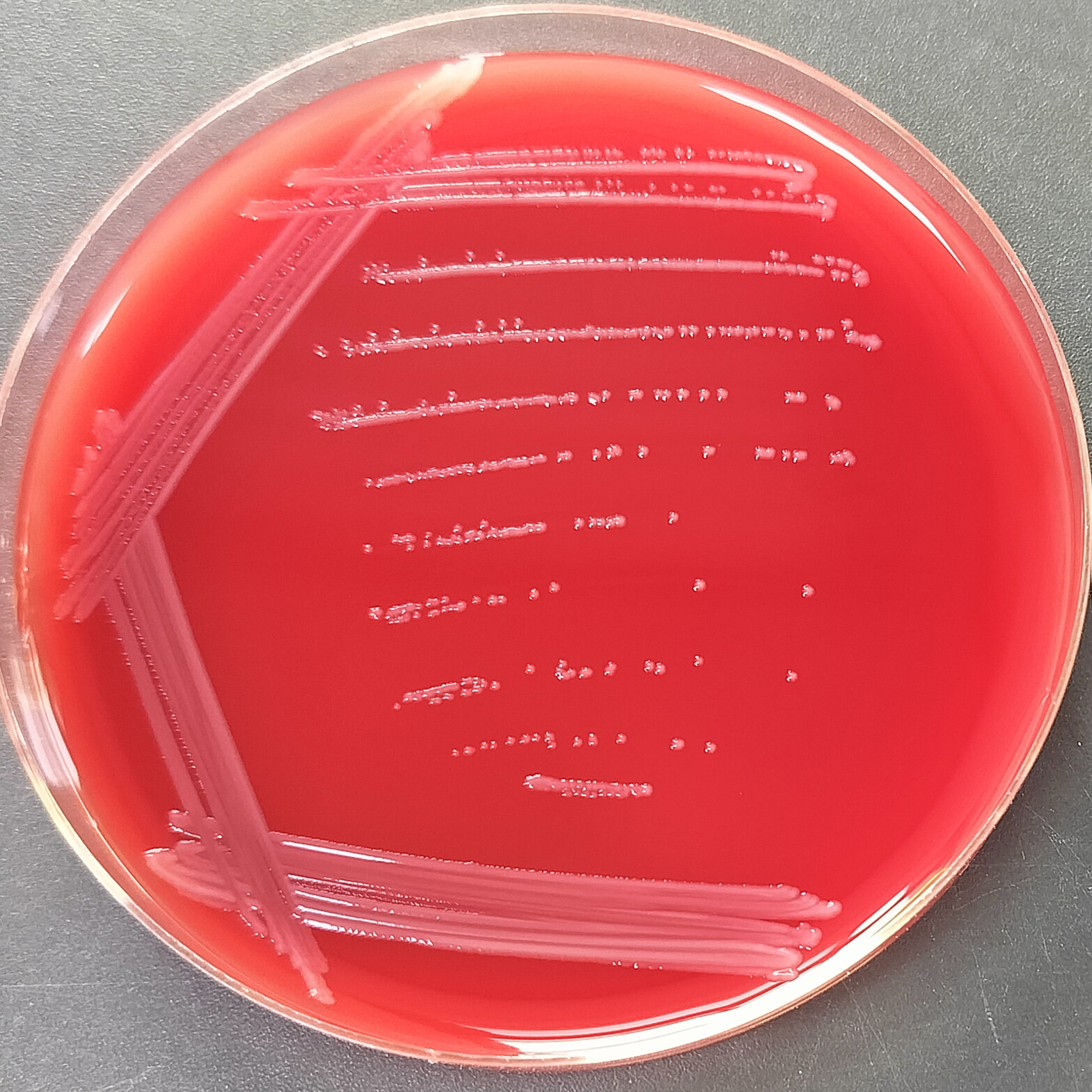 Escherichia coli-BNCC
