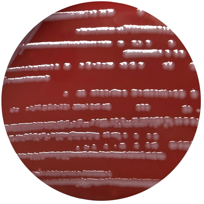 Escherichia coli-BNCC