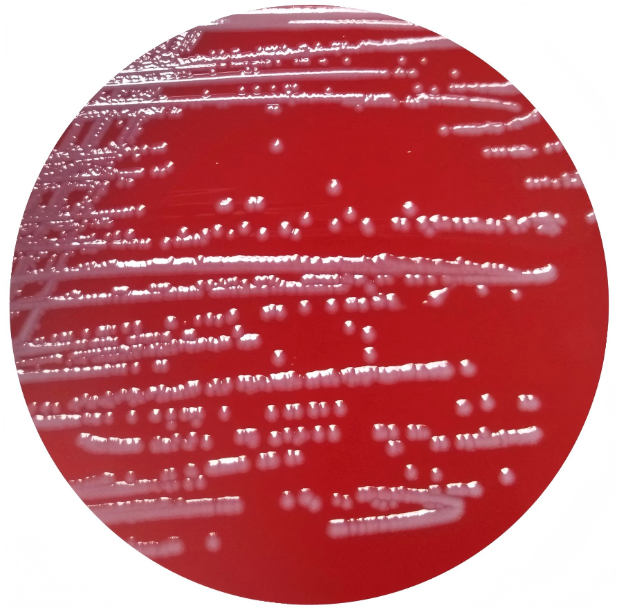 Escherichia coli-BNCC