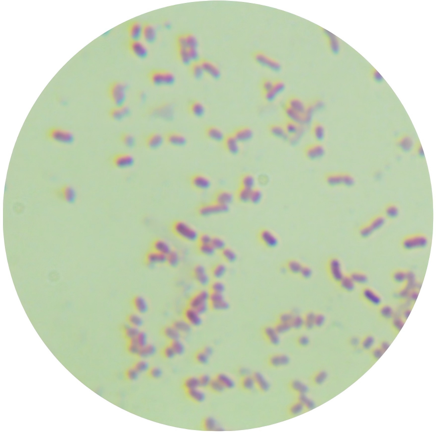 Escherichia coli-BNCC