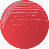 Escherichia coli-BNCC