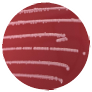 Escherichia coli-BNCC