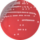 Escherichia coli-BNCC