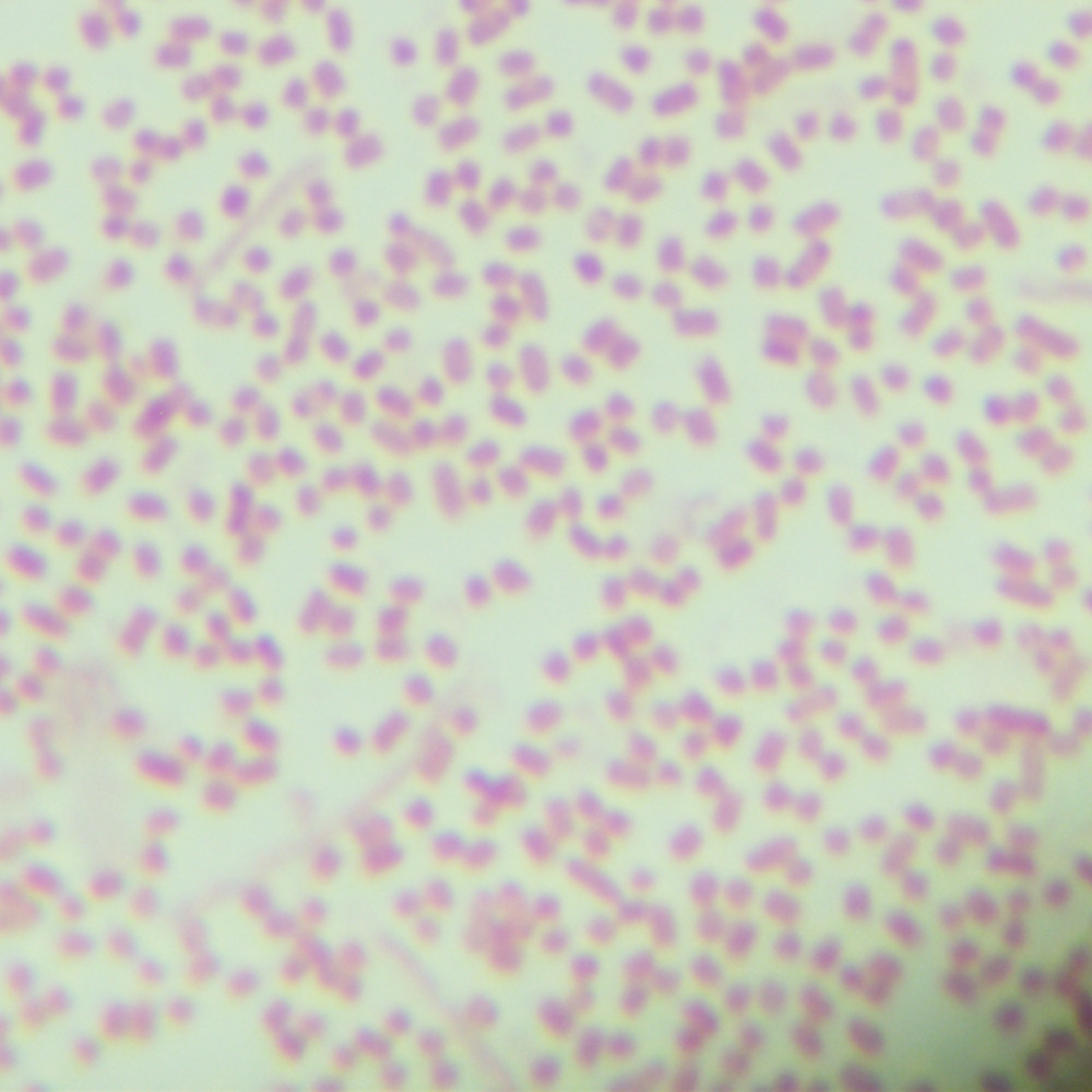 Escherichia coli-BNCC