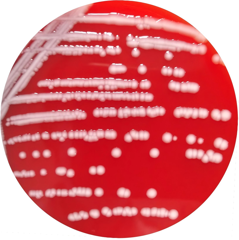 Escherichia coli-BNCC
