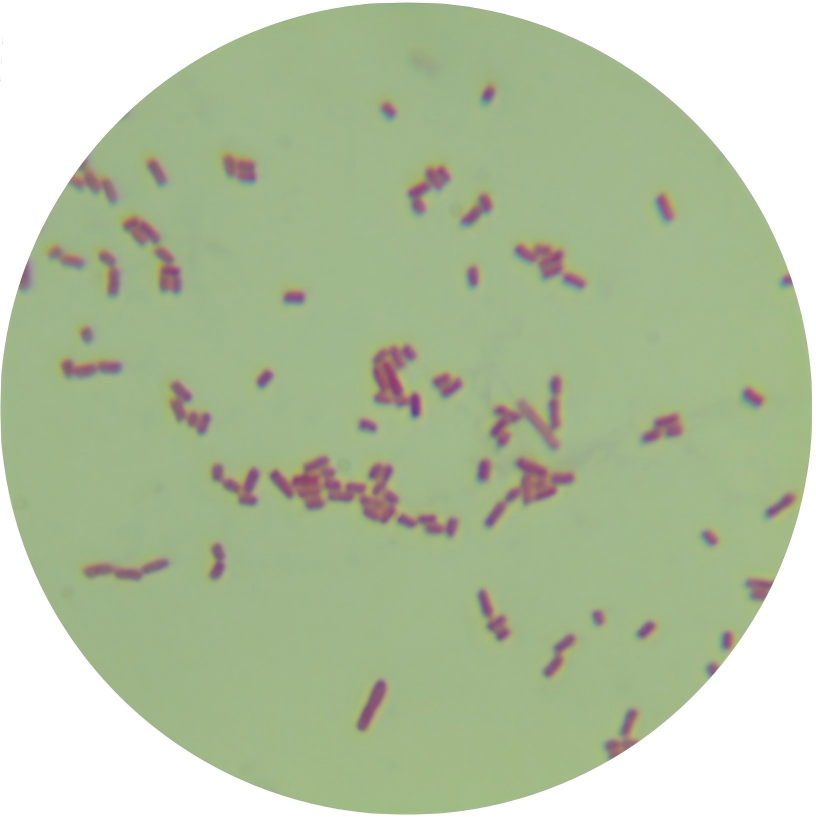 Escherichia coli-BNCC