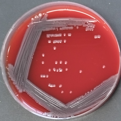 Escherichia coli-BNCC
