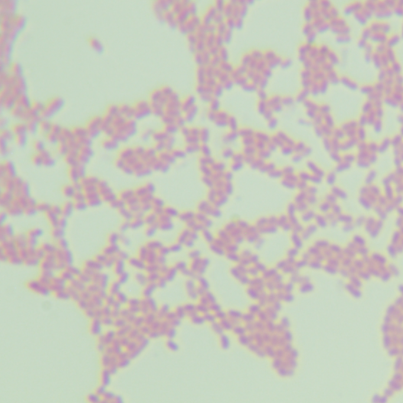 Escherichia coli-BNCC