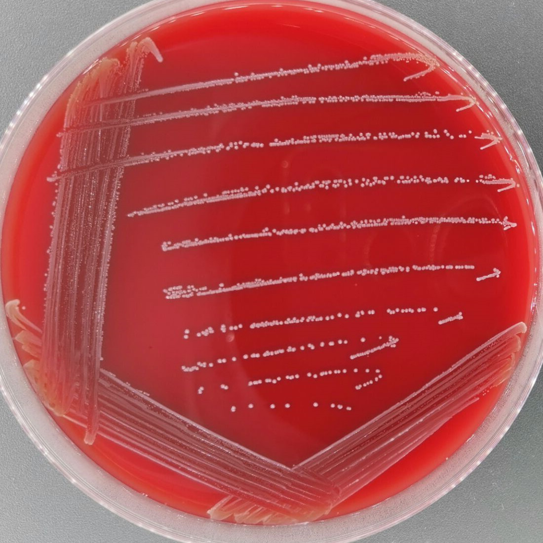 Enterococcus faecalis-BNCC