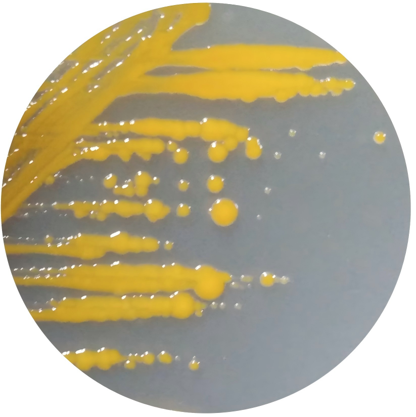 Pseudomonas aeruginosa-BNCC