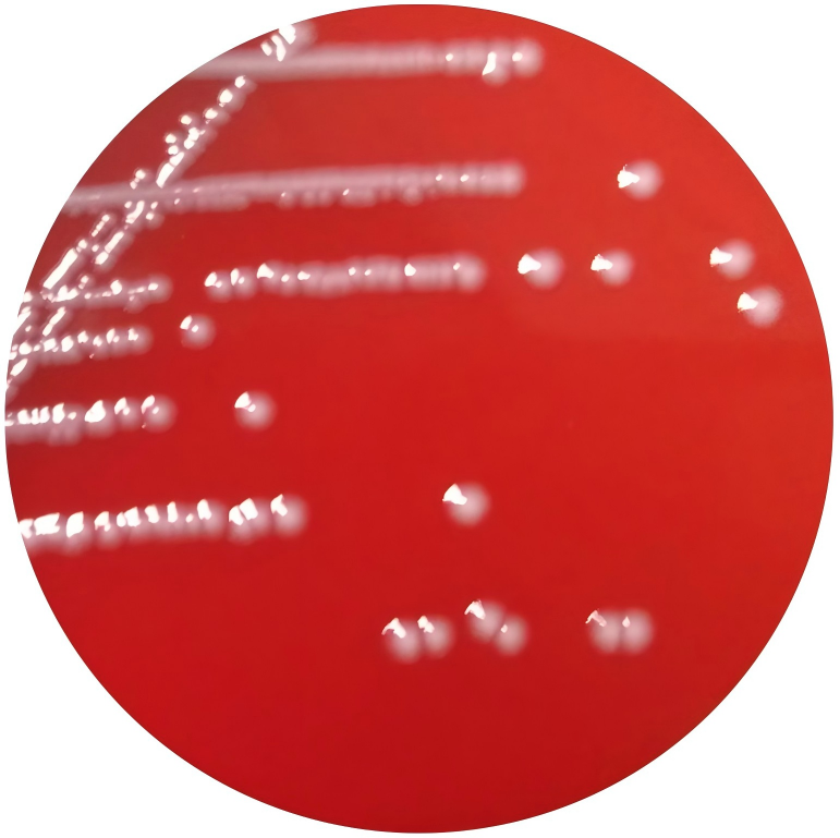 Escherichia coli-BNCC