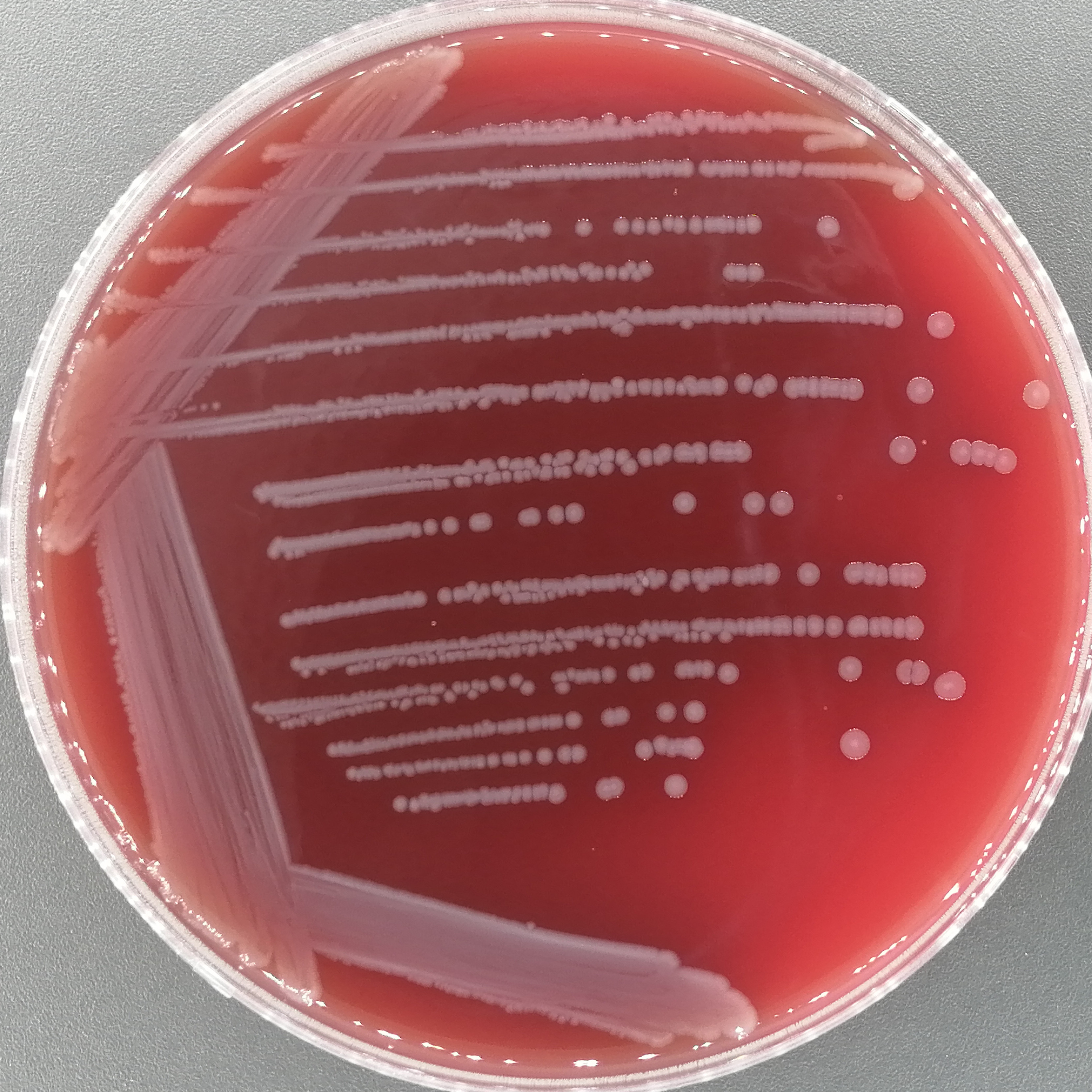 Enterococcus faecalis-BNCC
