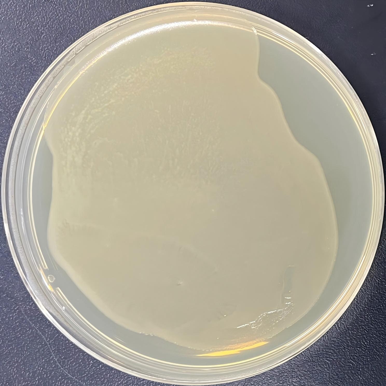 DH5α (containing pEGFP-N3 particles) E. coli-BNCC