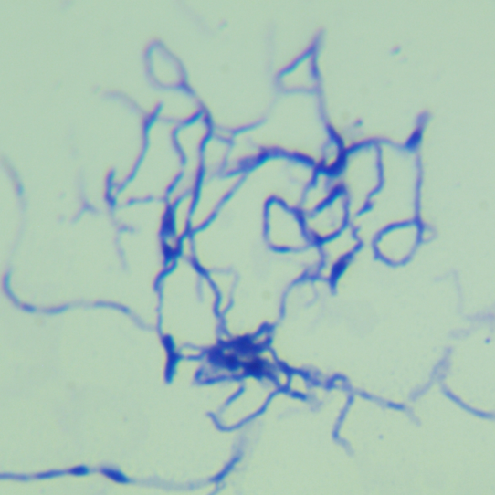 Rust-Swimming Actinomycetes-BNCC