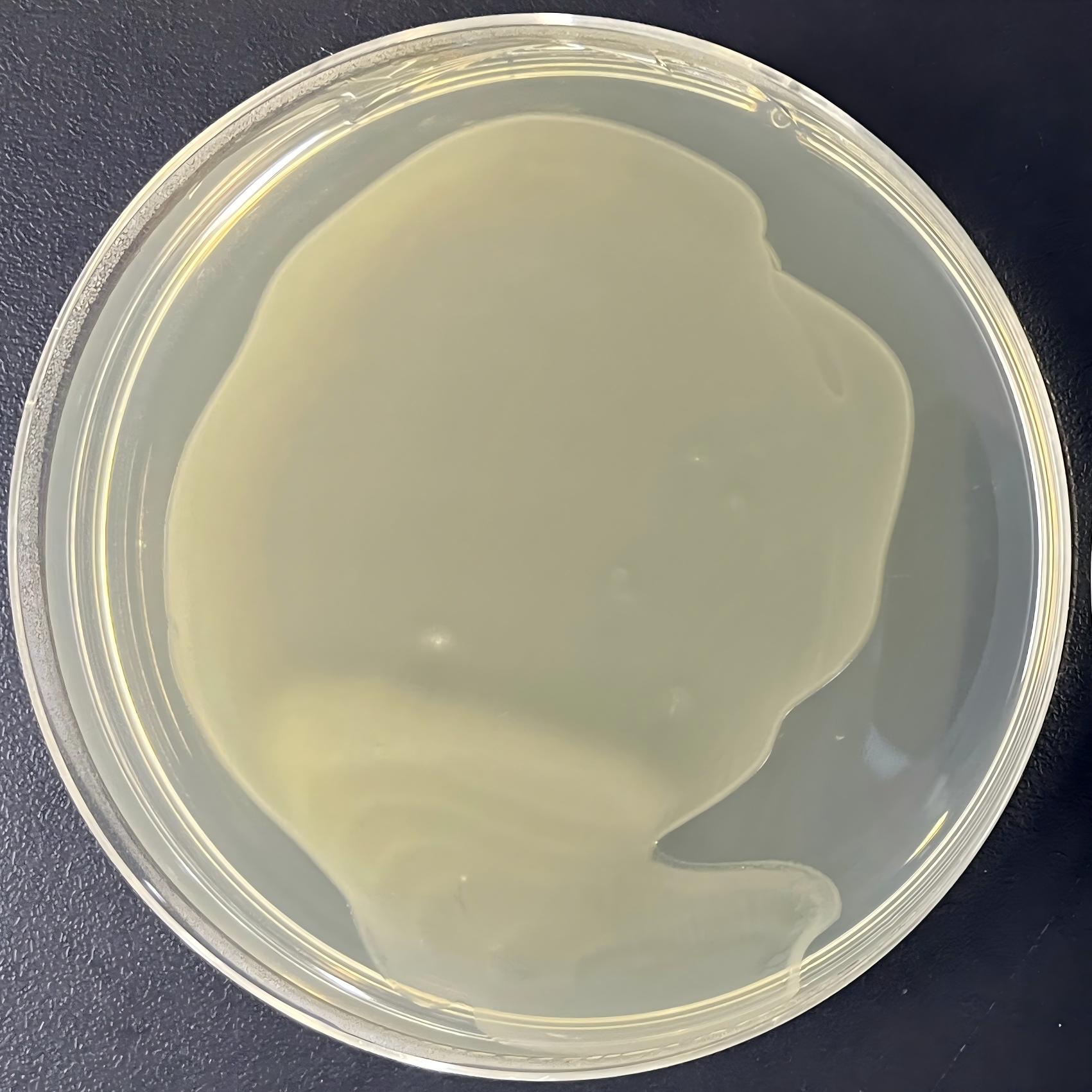 DH5α (containing pRS423 plasmid) E. coli-BNCC