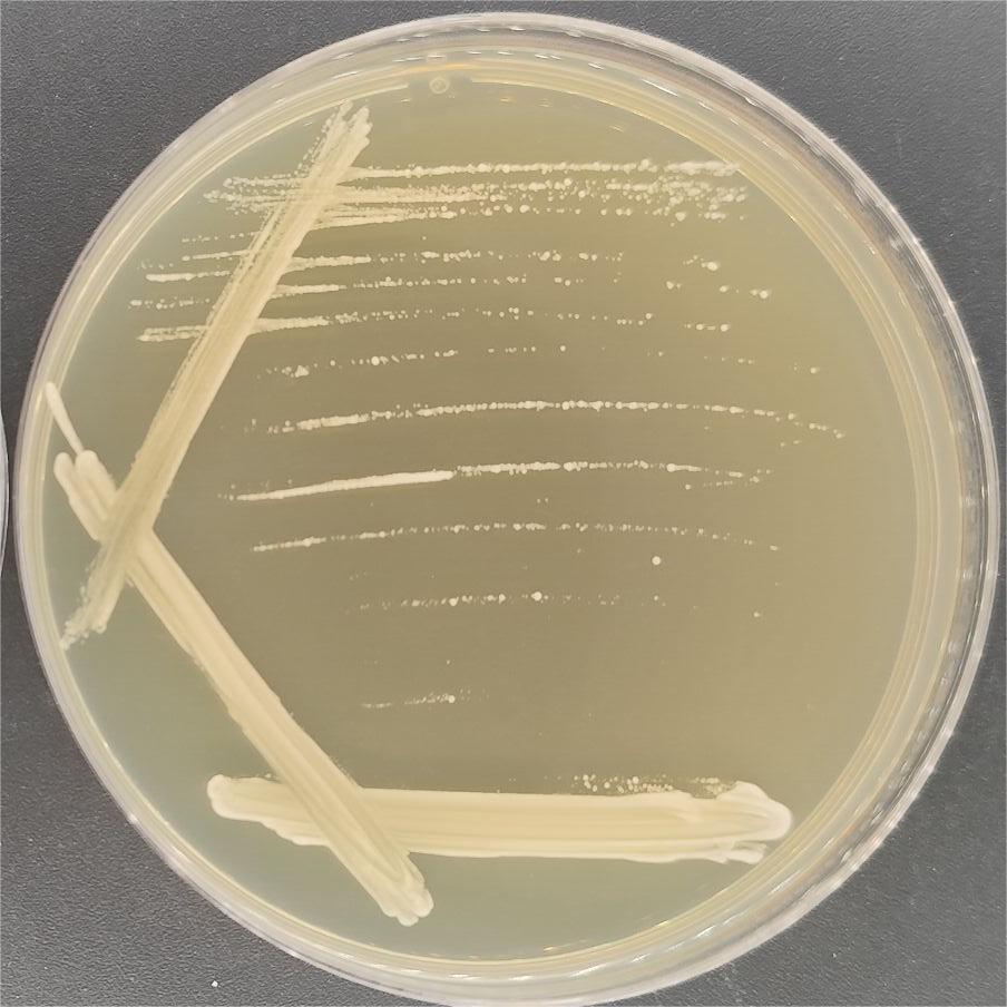 Saccharomyces cerevisiae R5421-BNCC