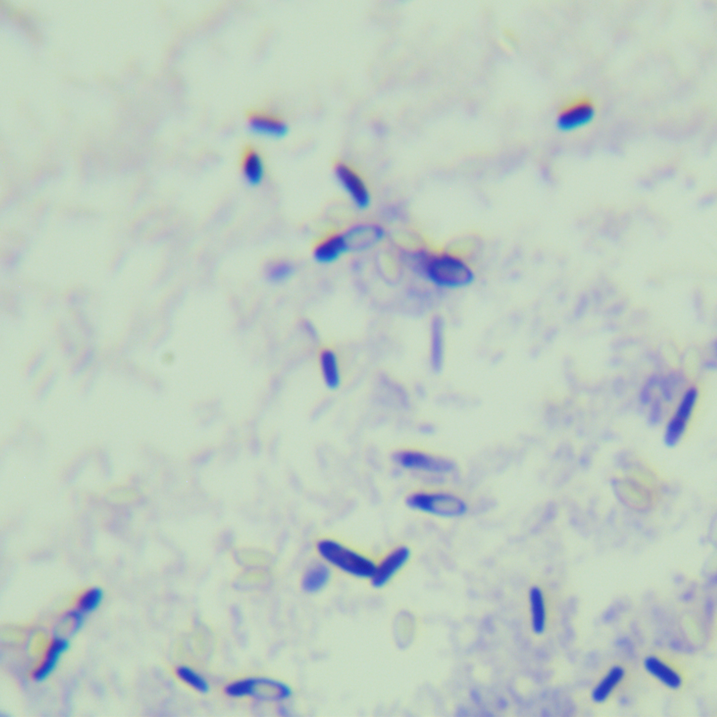 Bacillus subtilis-BNCC