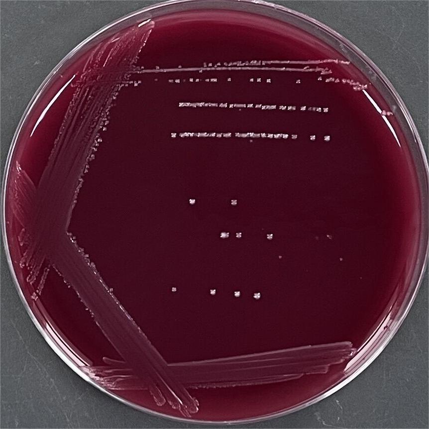 Symbiotic Clostridium-BNCC