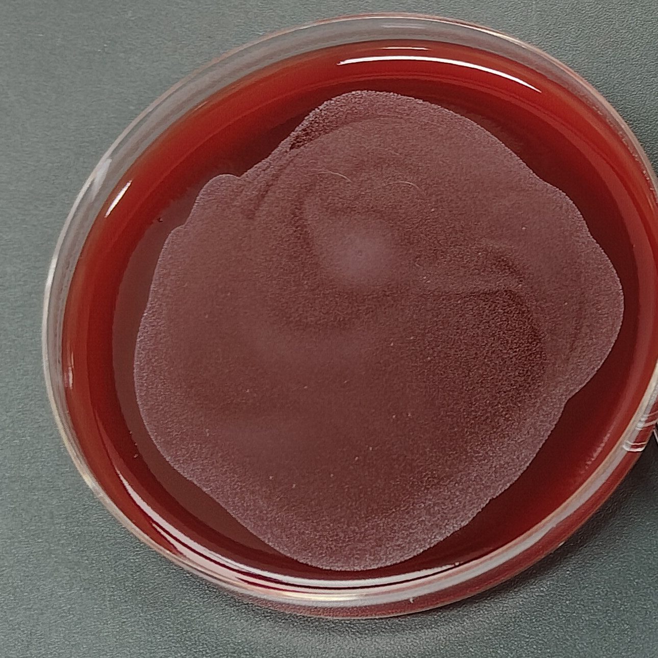 Clostridium difficile-BNCC