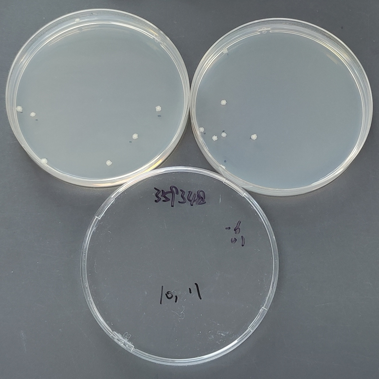 Secondary mycobacteria-BNCC