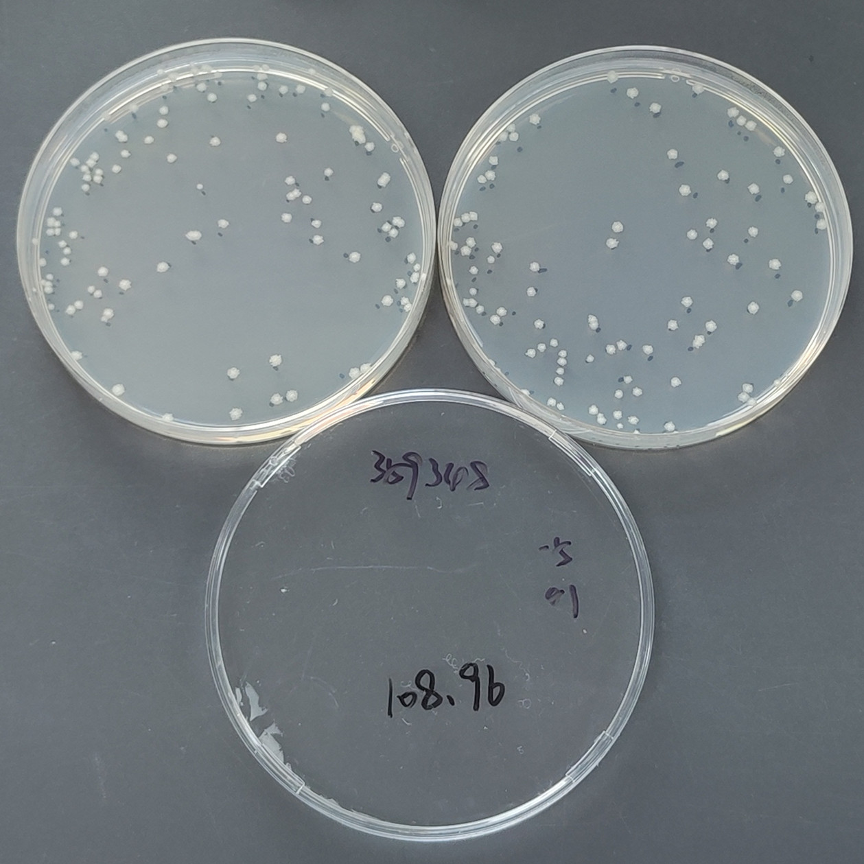 Secondary mycobacteria-BNCC
