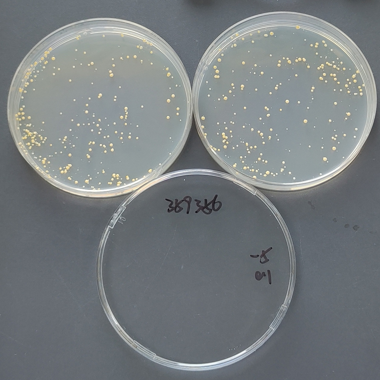 Intracellular mycobacteria-BNCC