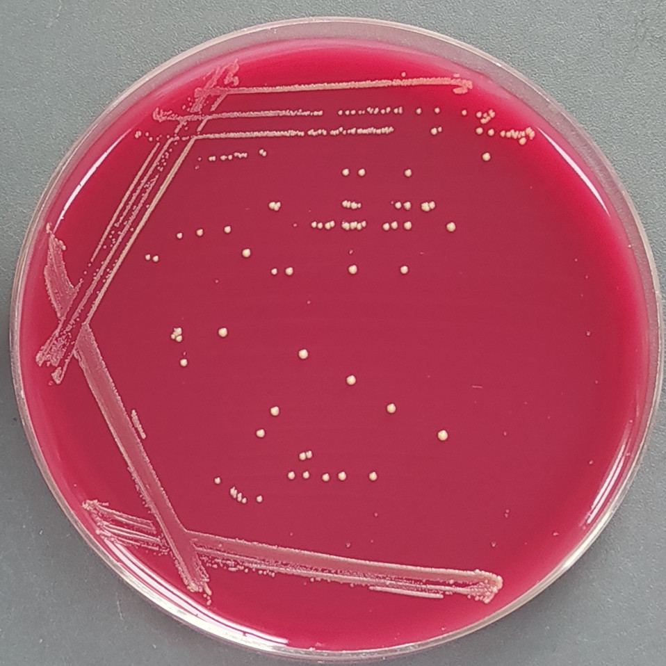 Escherichia coli-BNCC
