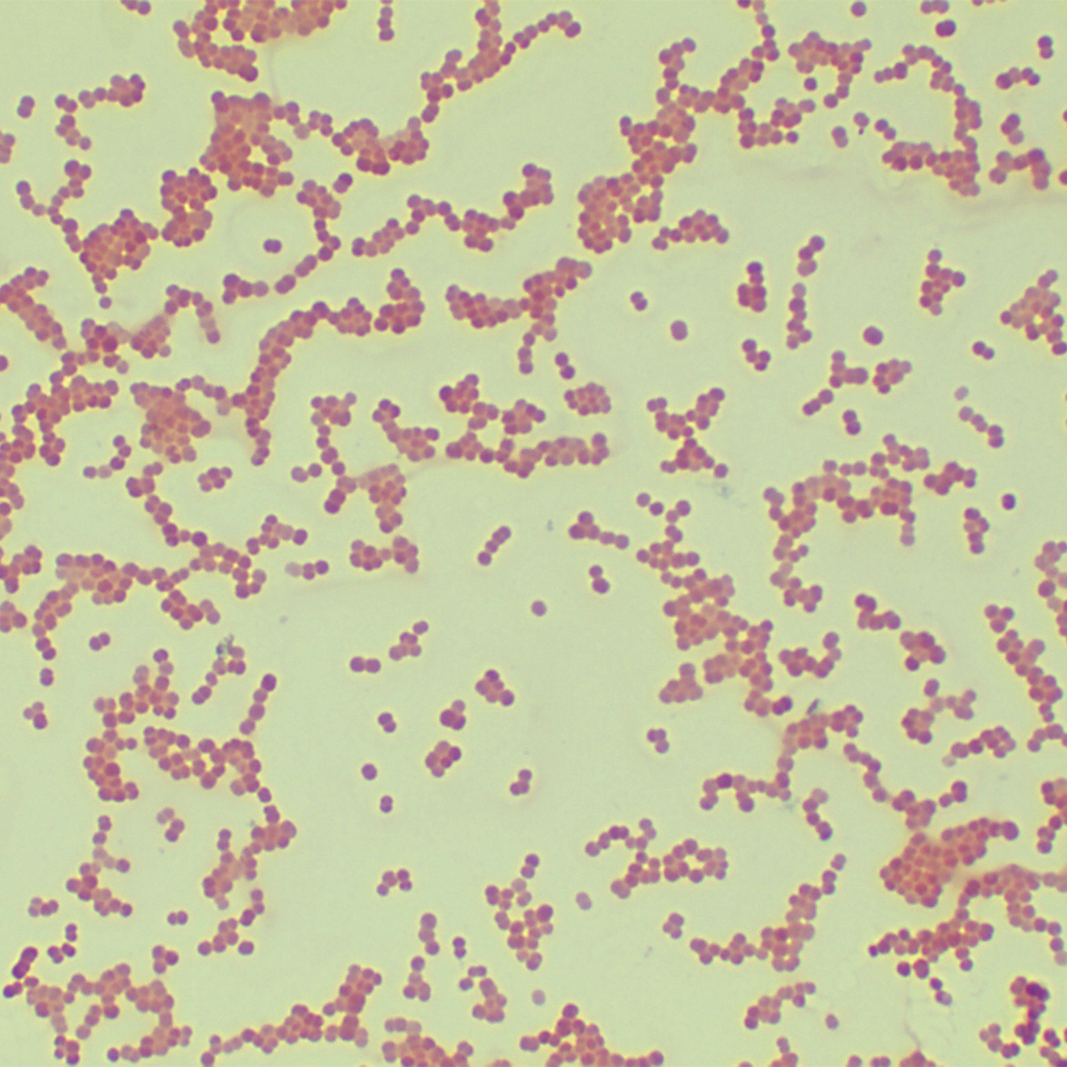 Escherichia coli-BNCC