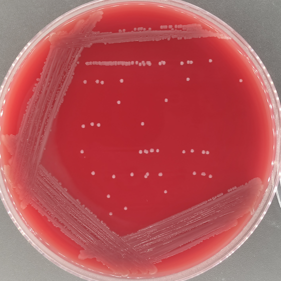 Neisseria meningitidis A-BNCC
