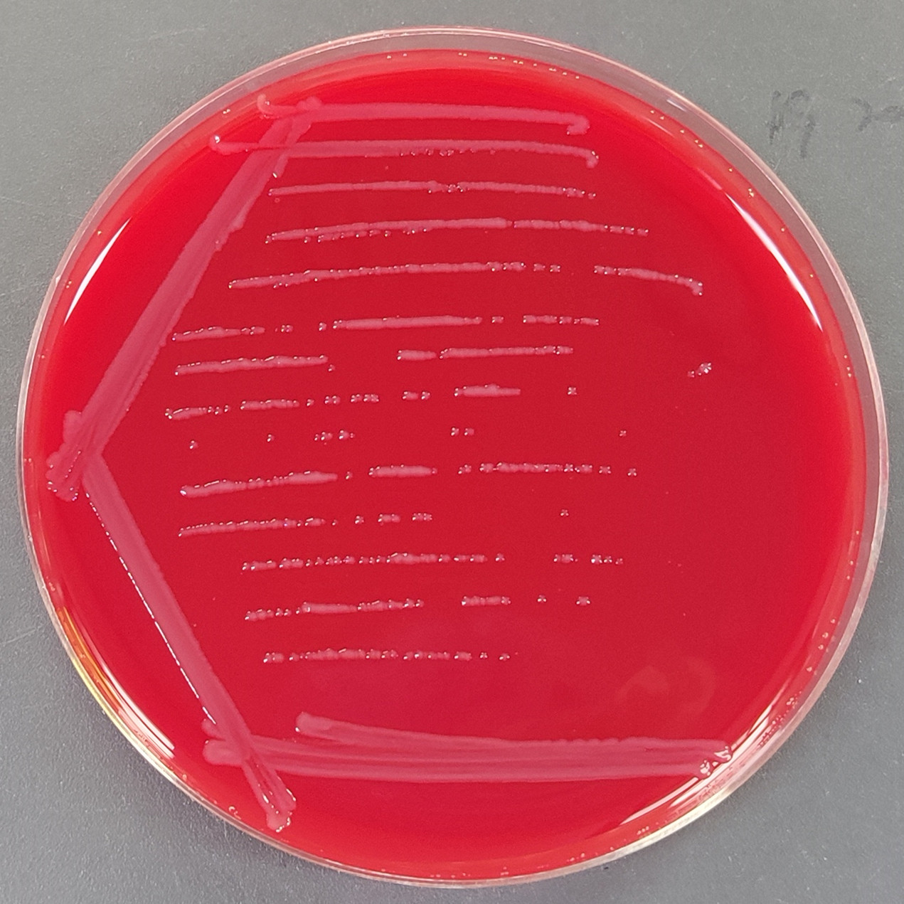 Neisseria meningitidis B-BNCC