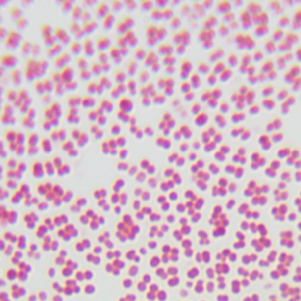 Neisseria meningitidis B-BNCC