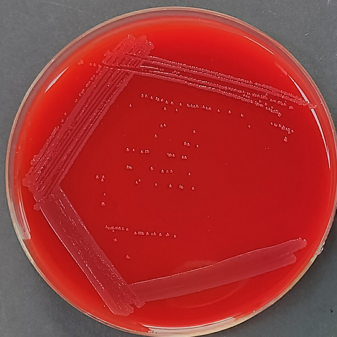 Neisseria meningitidis C-BNCC