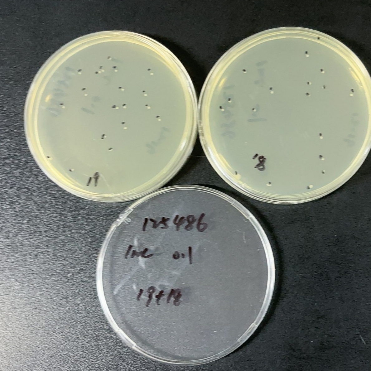 Quantitative strain of Pseudomonas aeruginosa-BNCC