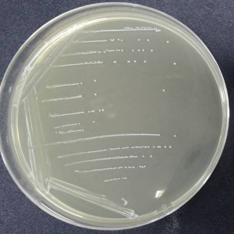 Streptococcus agalactiae-BNCC