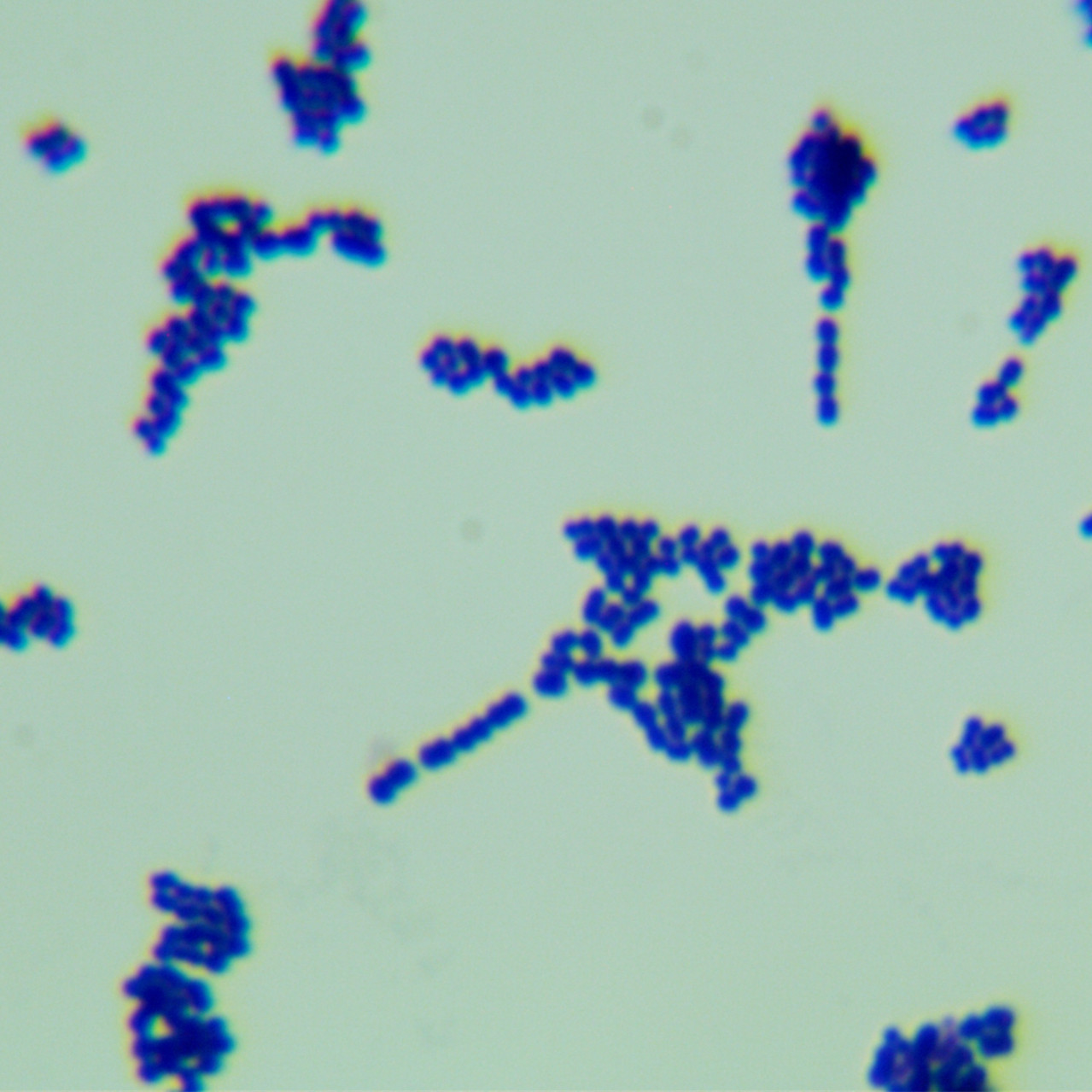 Streptococcus agalactiae-BNCC