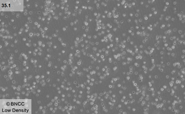Hybridoma cell anti-CD2-BNCC